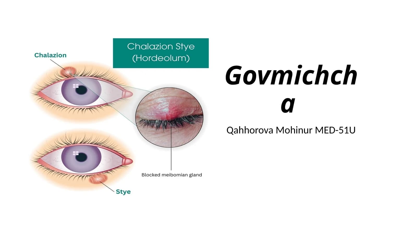 Govmichcha