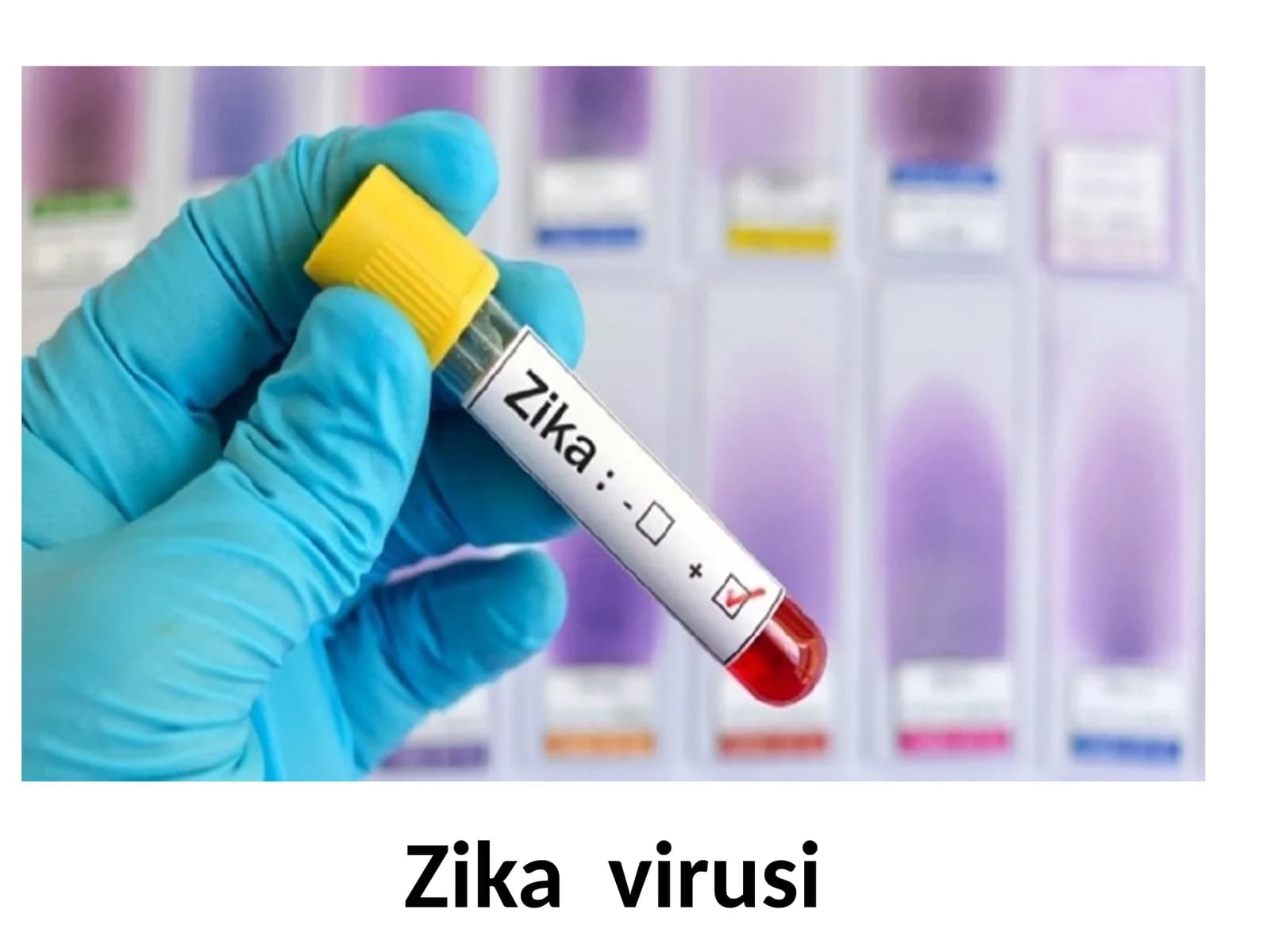 Zika virusi