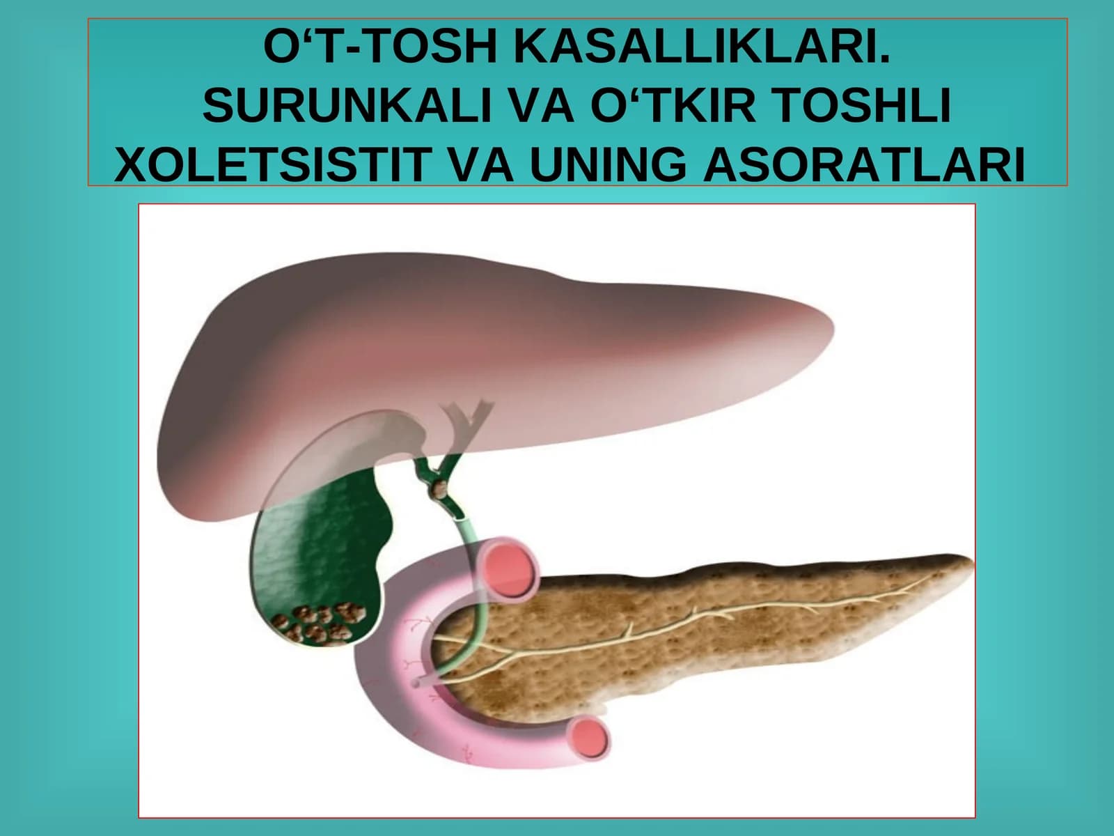 O‘T-TOSH KASALLIKLARI.SURUNKALI VA O‘TKIR TOSHLI XOLETSISTIT VA UNING ASORATLARI