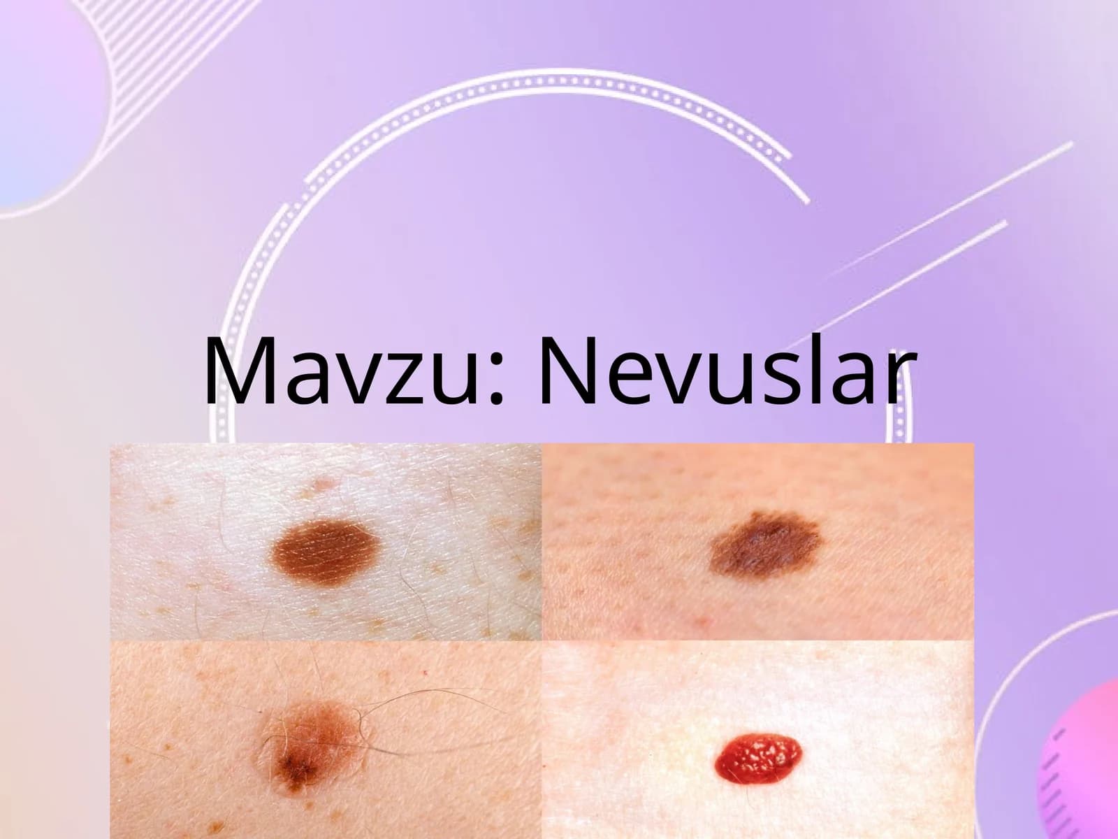 Nevuslar