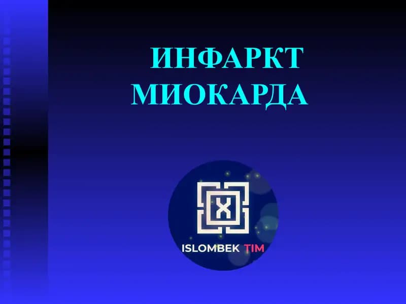 ИНФАРКТ МИОКАРДА