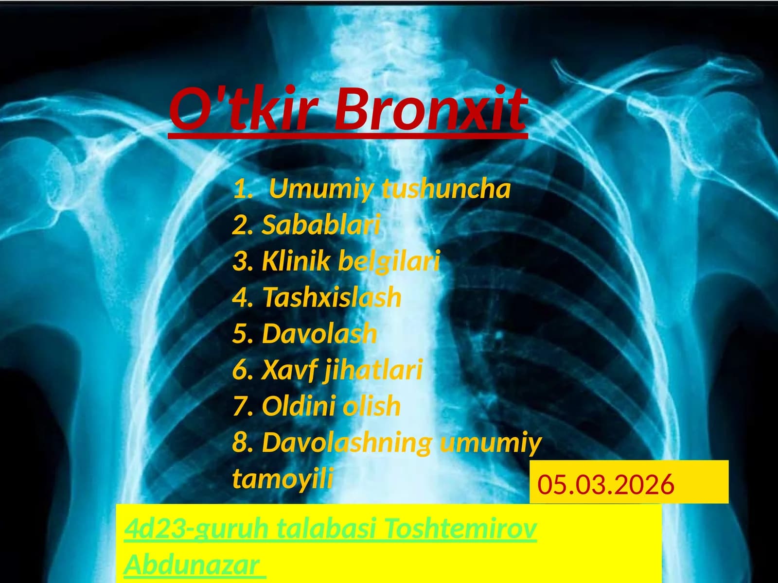 Oʻtkir Bronxit