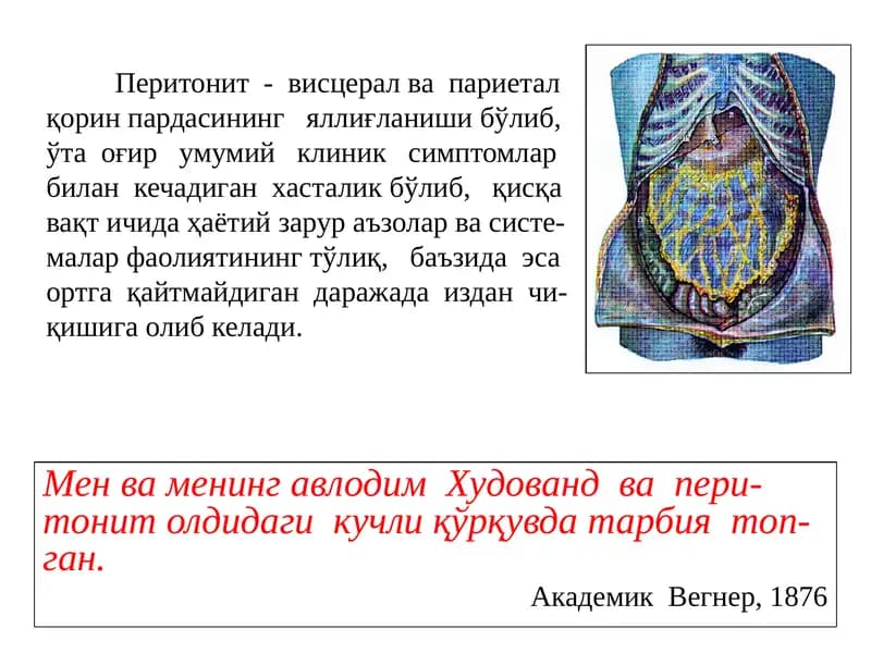 Перитонит