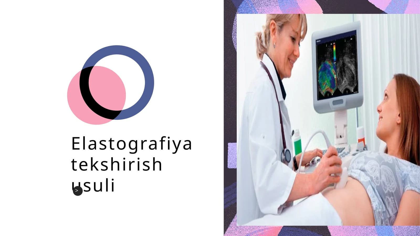 Elastografiya tekshirish usuli