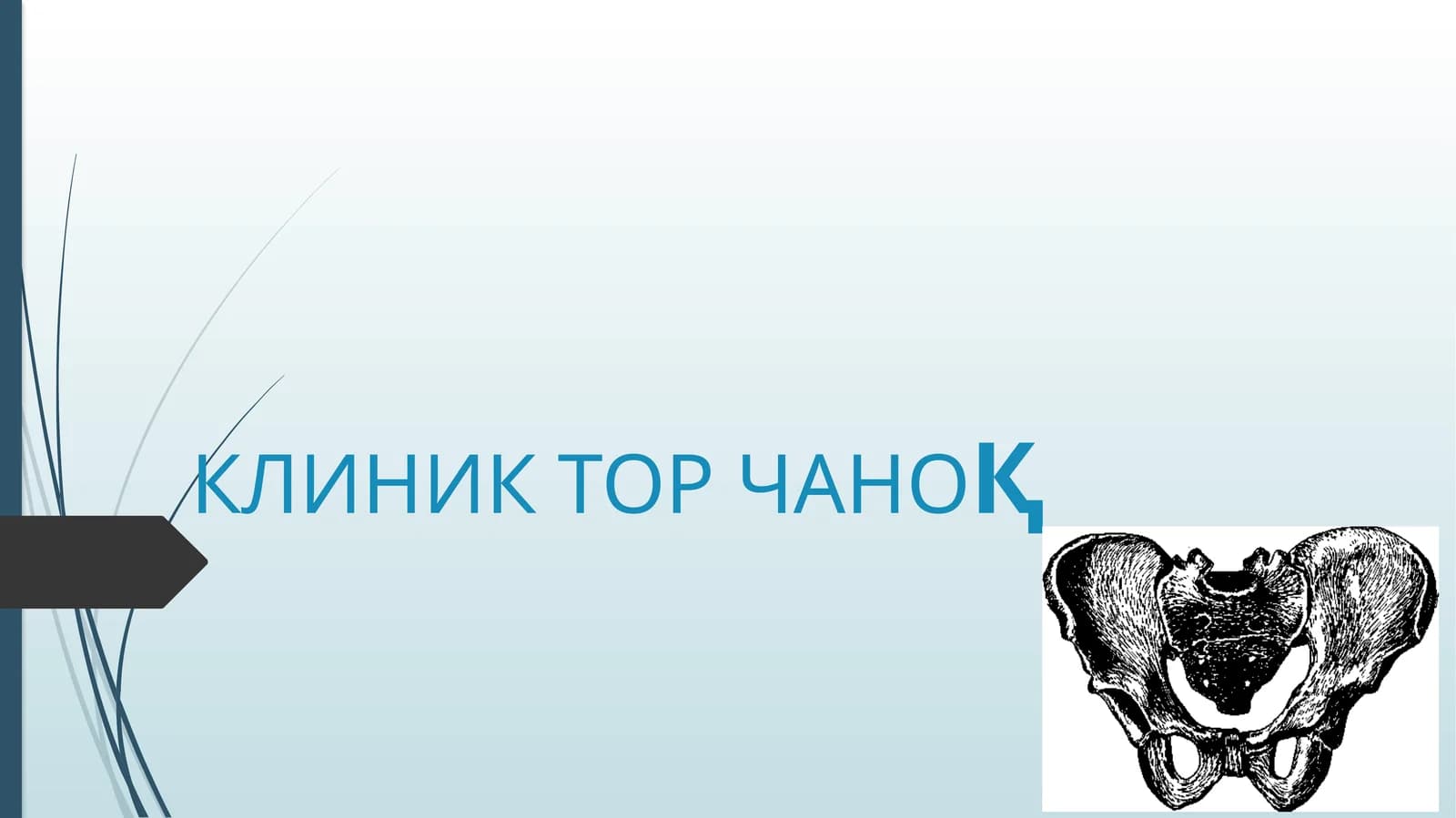 ТОР ЧАНОҚ