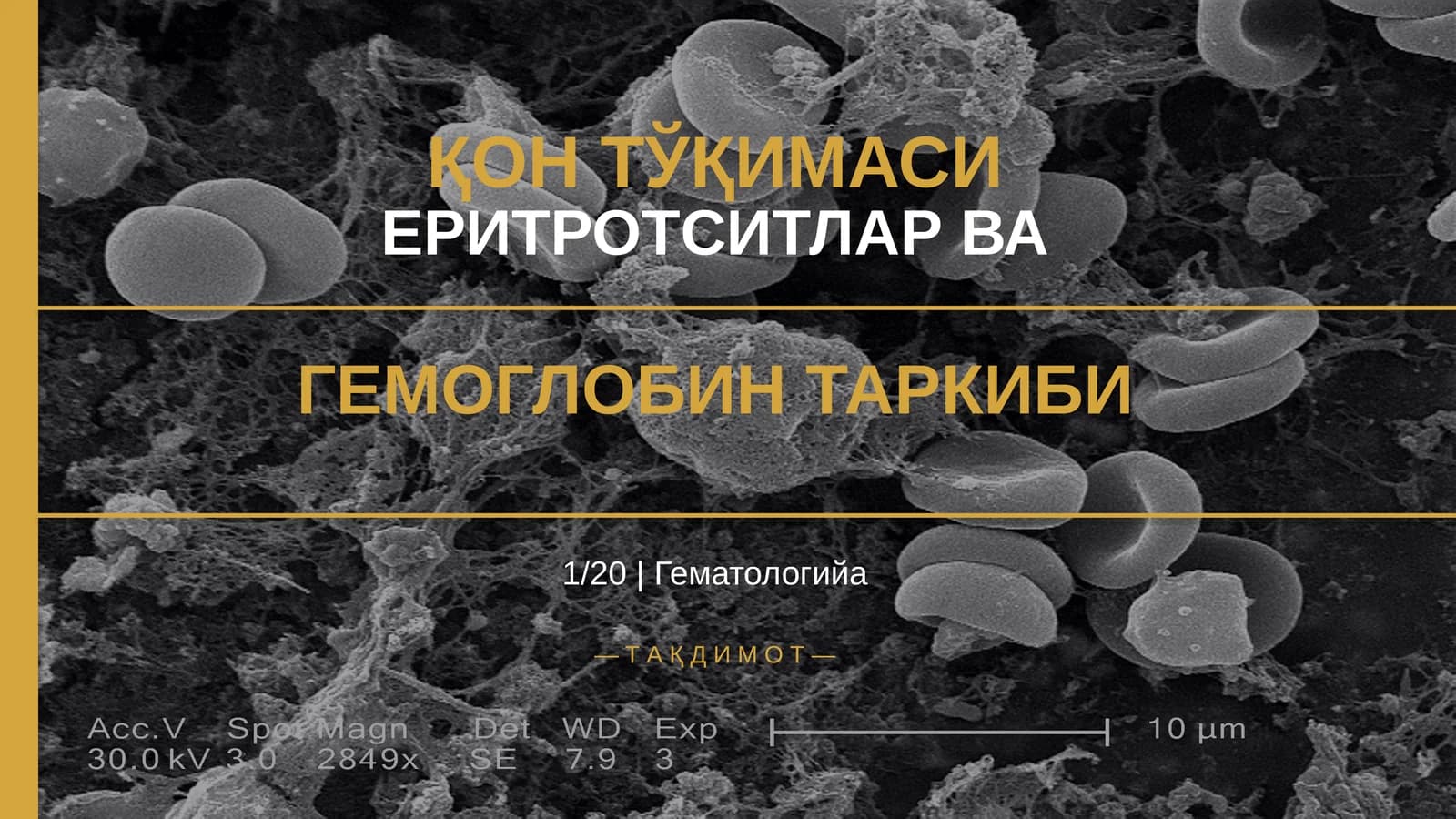 ҚОН ТЎҚИМАСИ