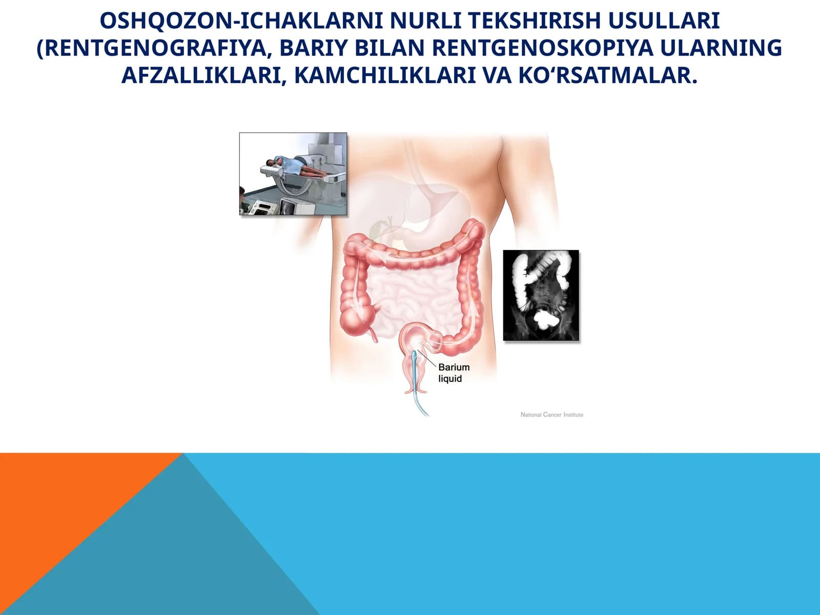 Ovqat hazmiyo’llari (OHY)ning rentgenologik metodi