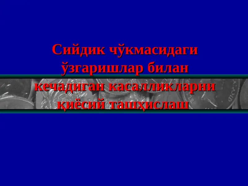 Siydik cho'kmasi