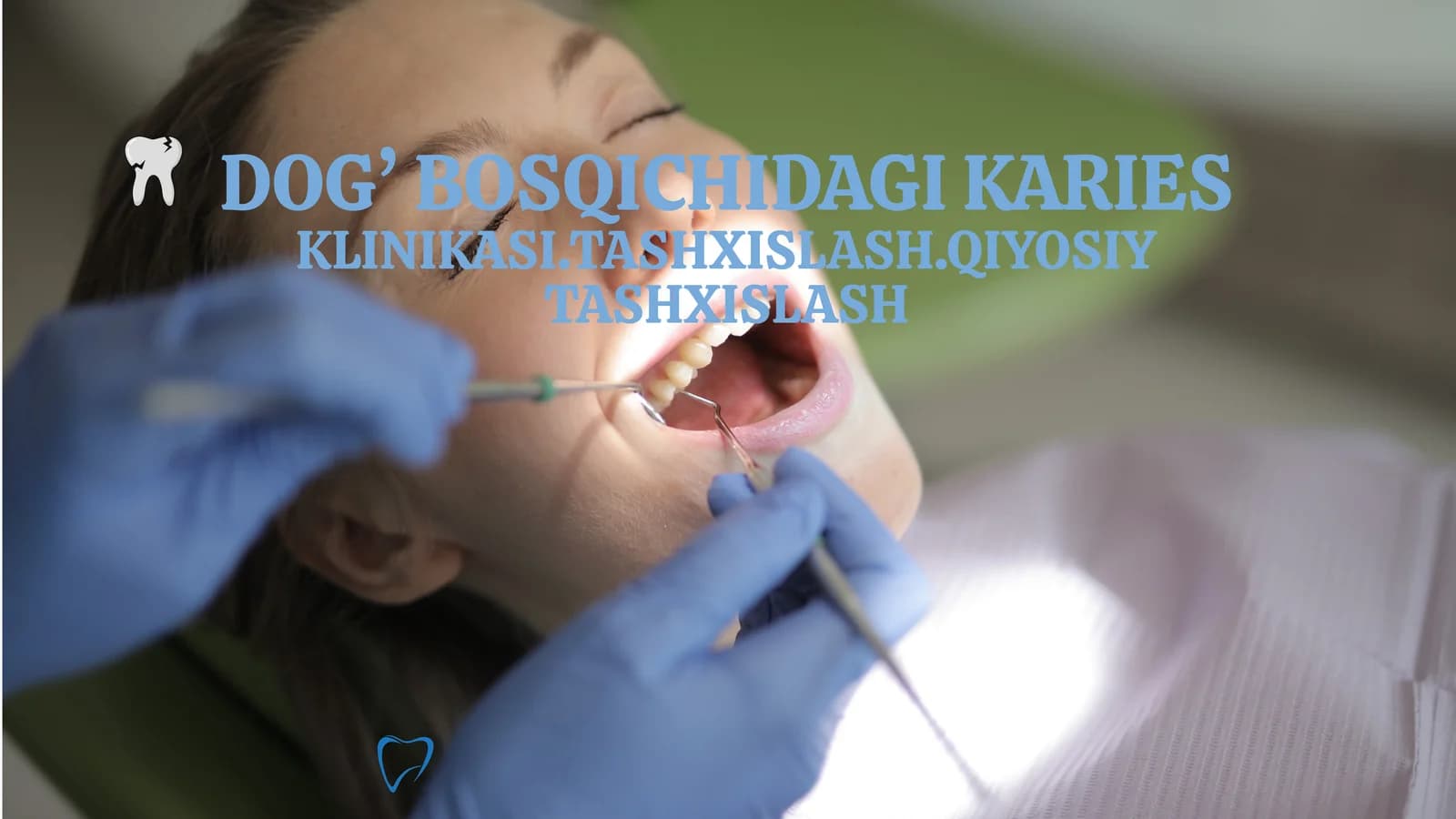 DOG’ BOSQICHIDAGI KARIES