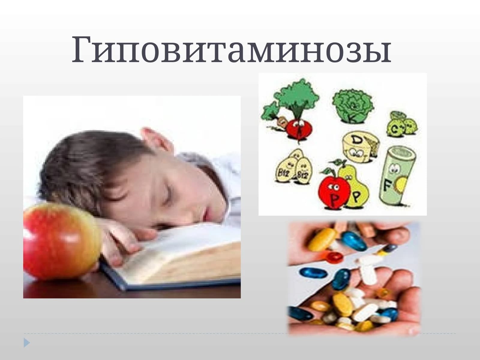 Гиповитаминозы