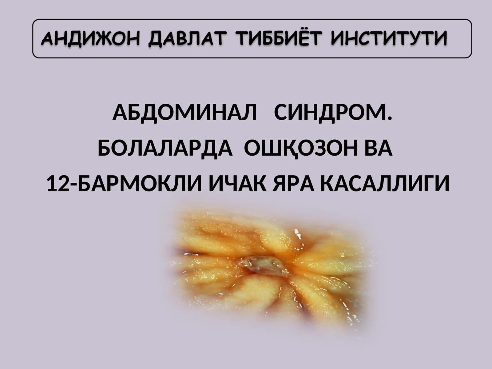 Яра касаллиги
