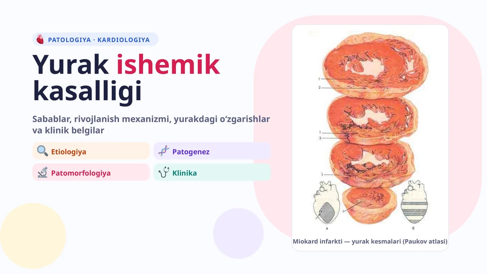 Yurak ishemik kasalligi. Stenokardiyalar va o'tkir miokard infarkti. Klinik-laborator 6 tekshiruv natijalarini tahlil qilishni, to'plangan ma'lumotlar asosida taxminiy tashxis qo'yishni, birinchi yordam ko'rsatishni hamda keyingi taktikani aniqlashni o'rgatish. O'tkir koronar sindrom va Miokard infarktida stomatolog taktikasi.