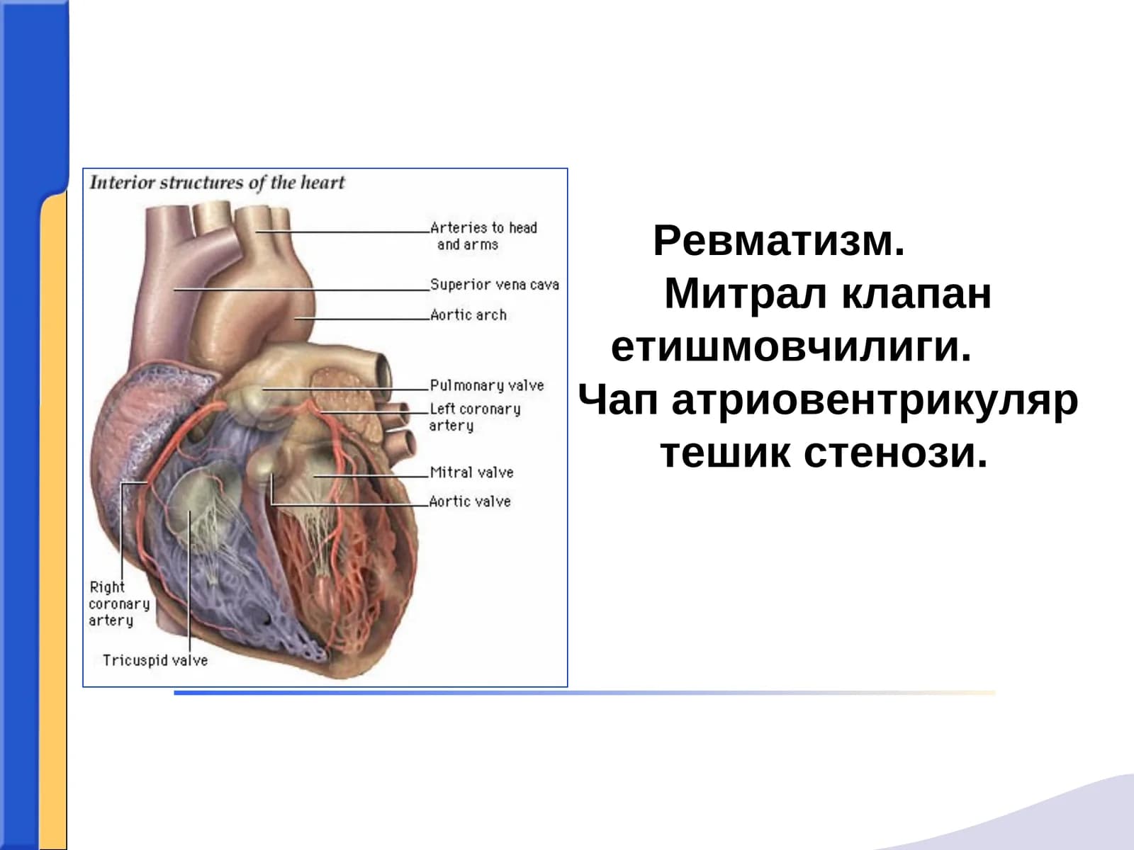 Ревматизм (Сокольский-Буйо касаллиги)