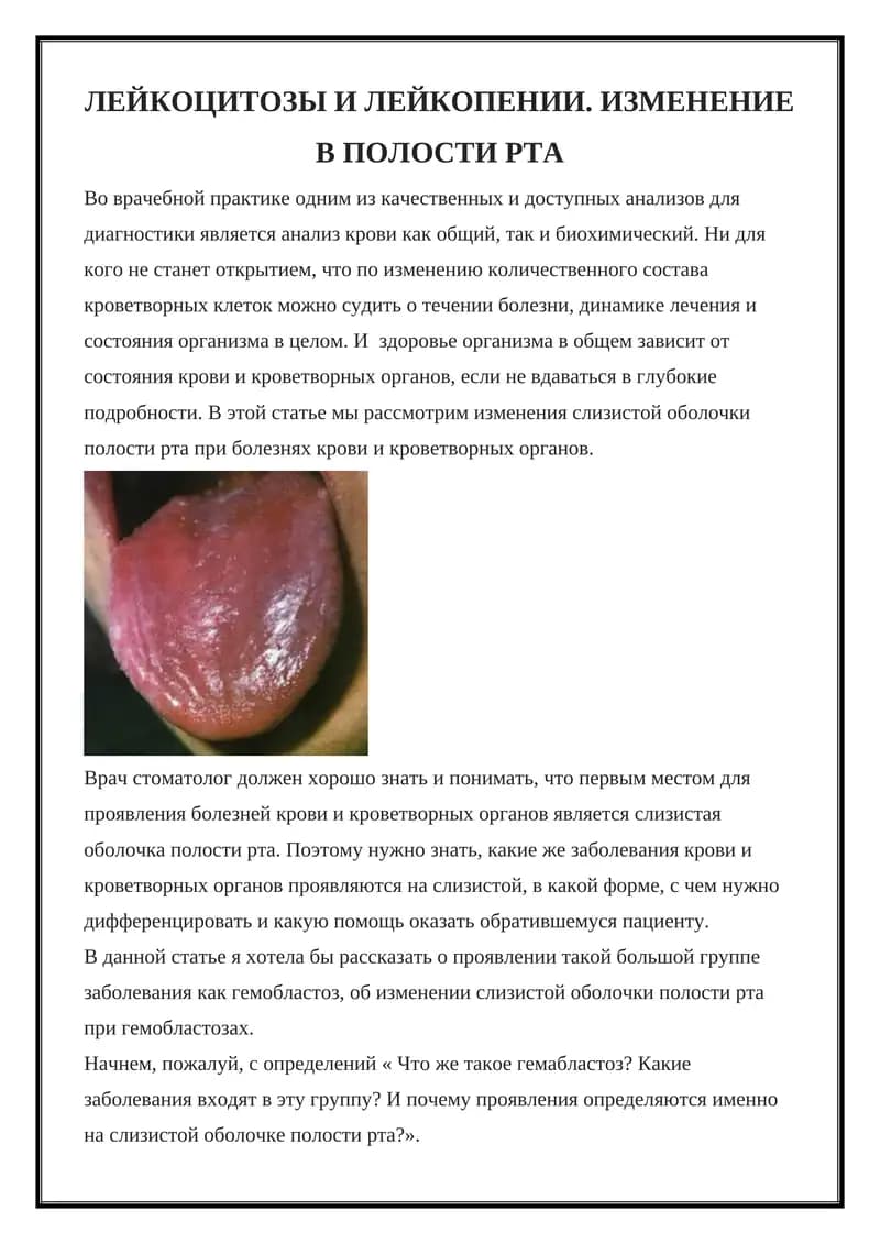 Гемобластозы