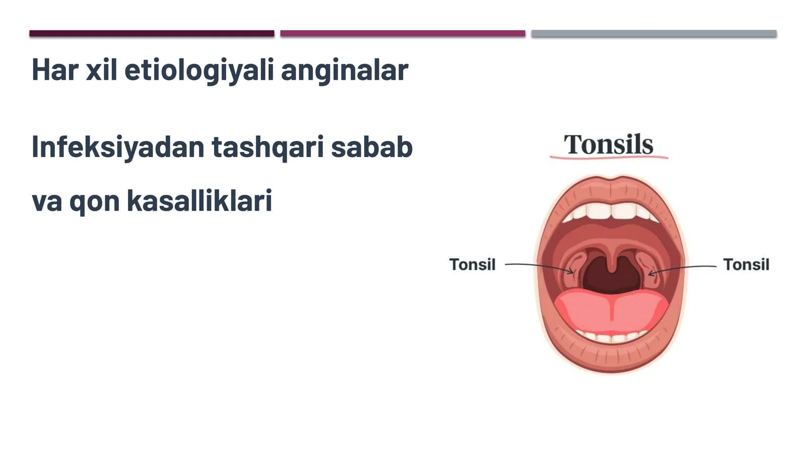 Angina (tonzillit)