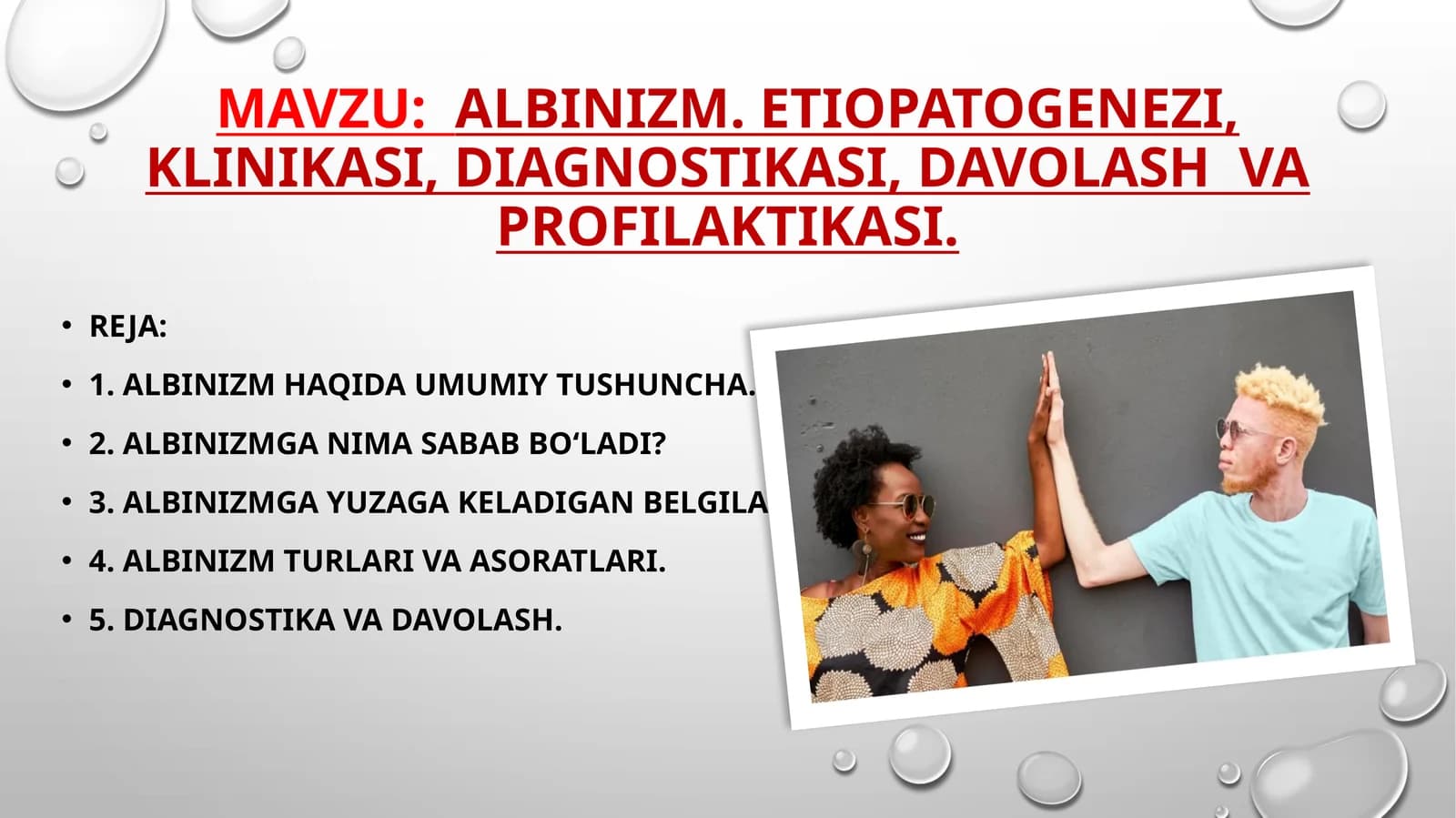 Albinizm. Etiopatogenezi, klinikasi, diagnostikasi, davolash va profilaktikasi