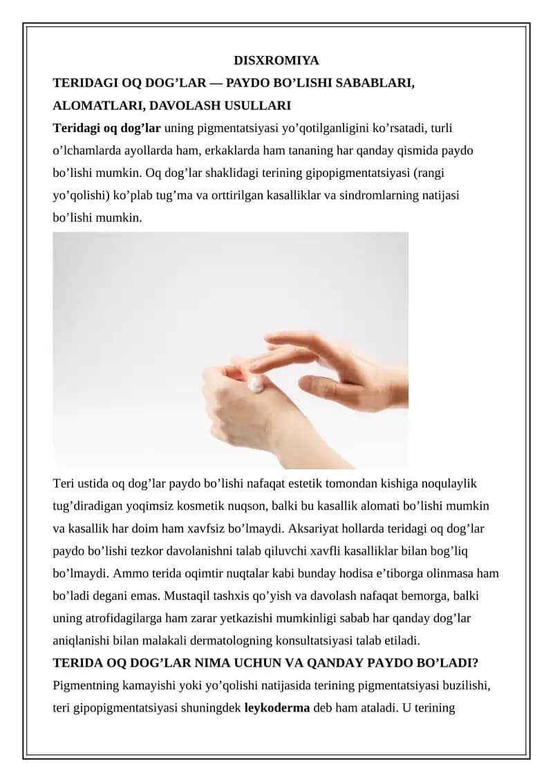 Teridagi oq dog’lar