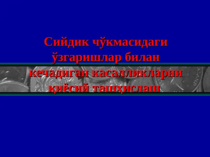 Сийдик чўкмасидаги ўзгаришлар билан кечадиган касалликларниқиёсийташҳислаш