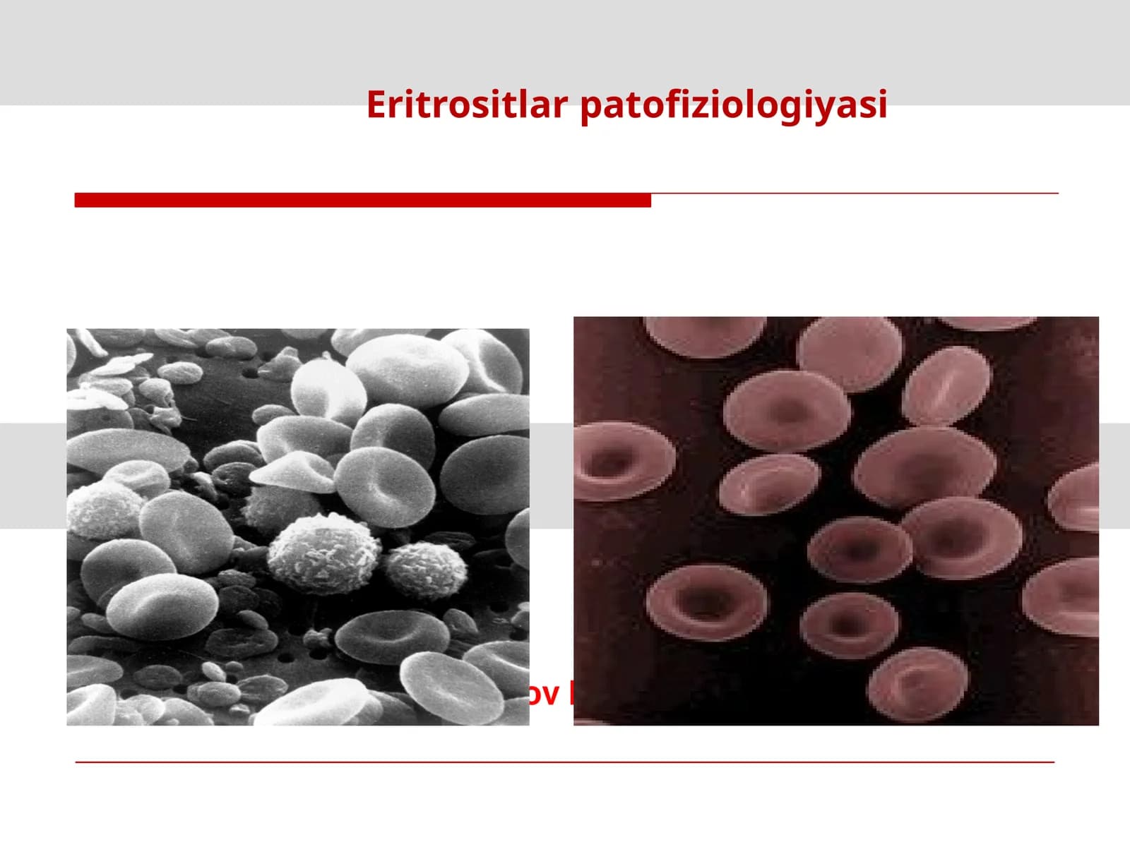 Eritrositlar patofiziologiyasi