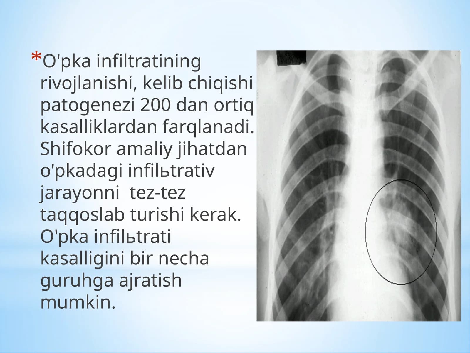 O'pkainfiltratsiyasi va kasalliklari