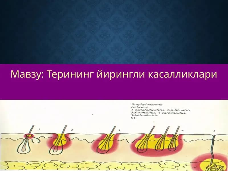 Терининг йирингли касалликлари