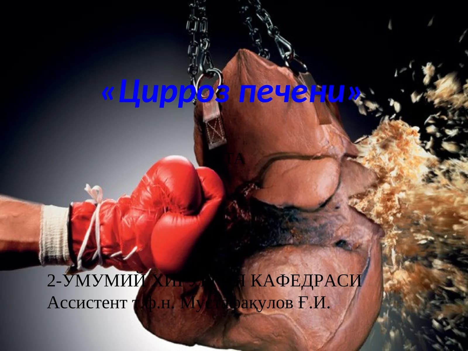 Цирроз печени