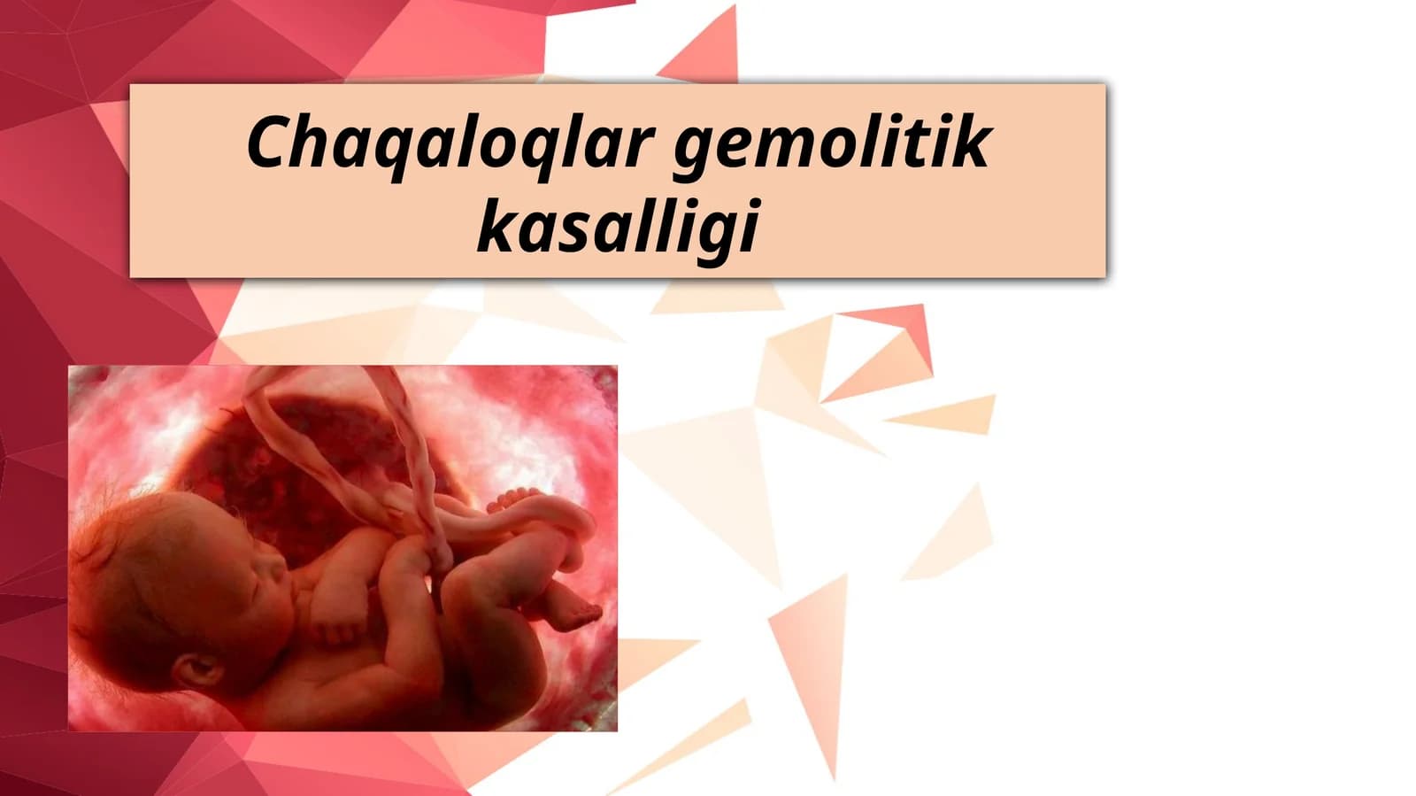 Chaqaloqlar gemolitik kasalligi