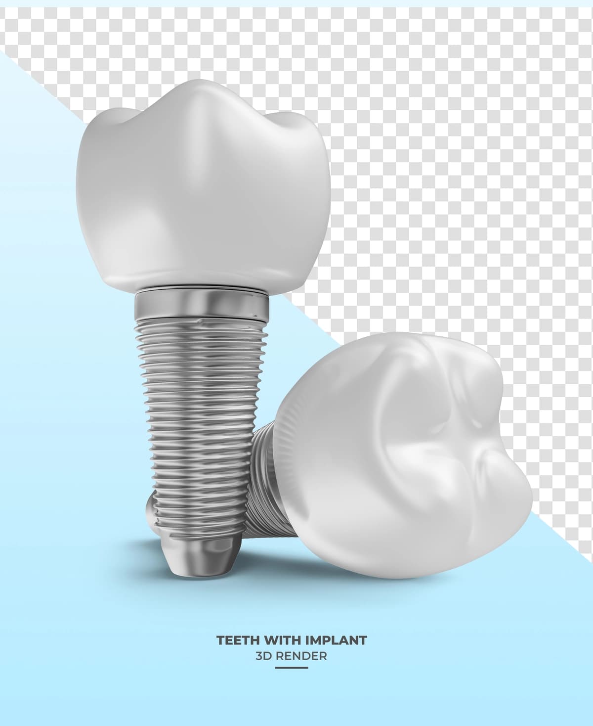 Shaffof fon bilan implantlangan tishning 3D render tasviri | Tooth with implants 3d render with transparent background
