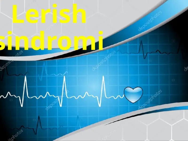 Lerish sindromi Aorto-iliak okklyuziv kasalliklar