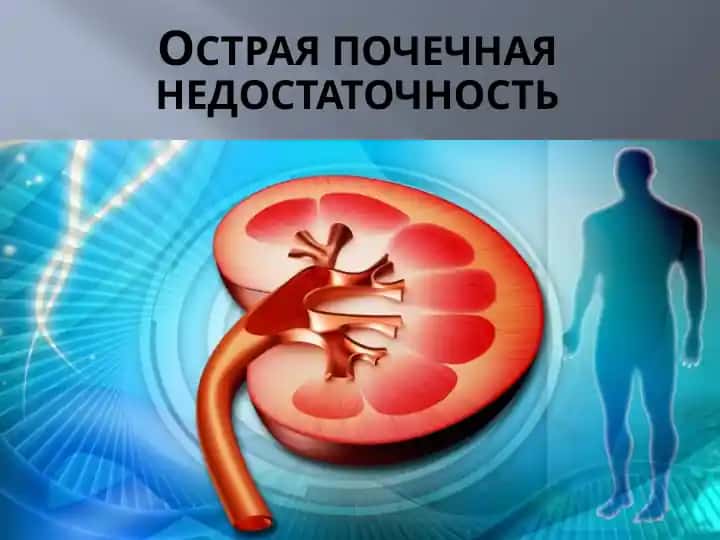 Острая почечная недостаточность