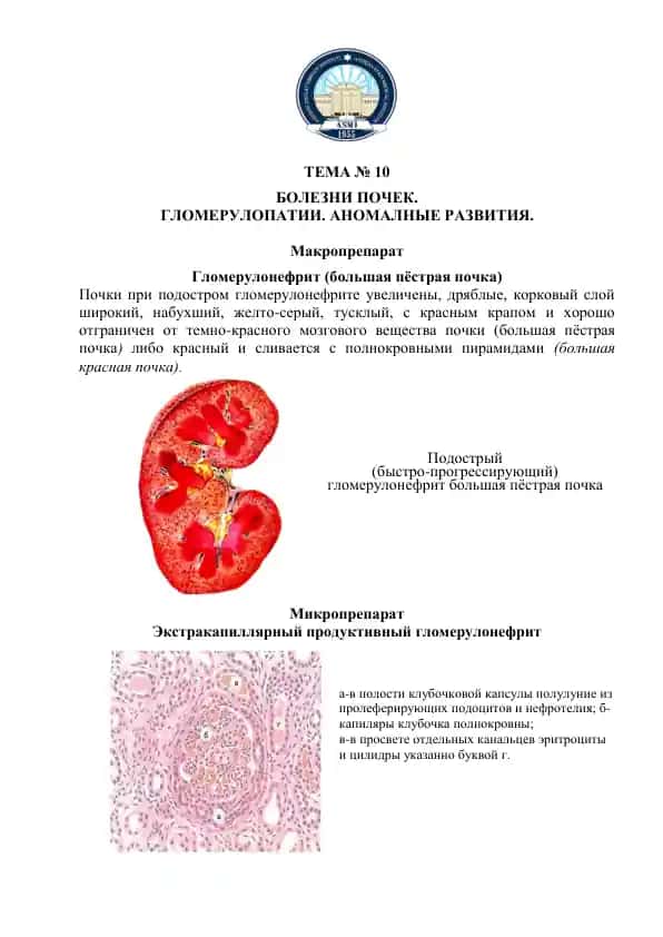Гломерулонефрит (большая пёстрая почка)