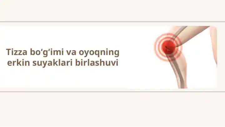 Tizza bo'g'imi va oyoqning erkin suyaklari birlashuvi