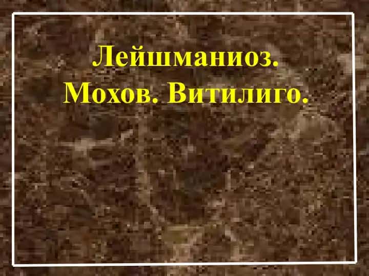 Лейшманиоз