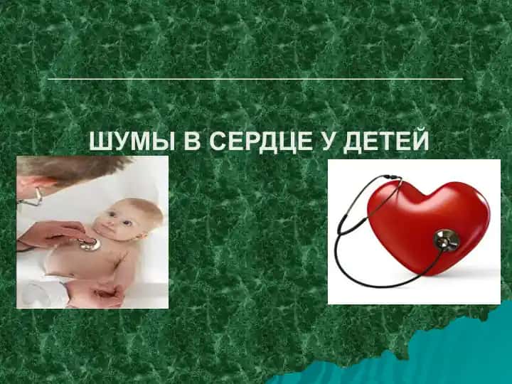 Шумы в сердце у детей