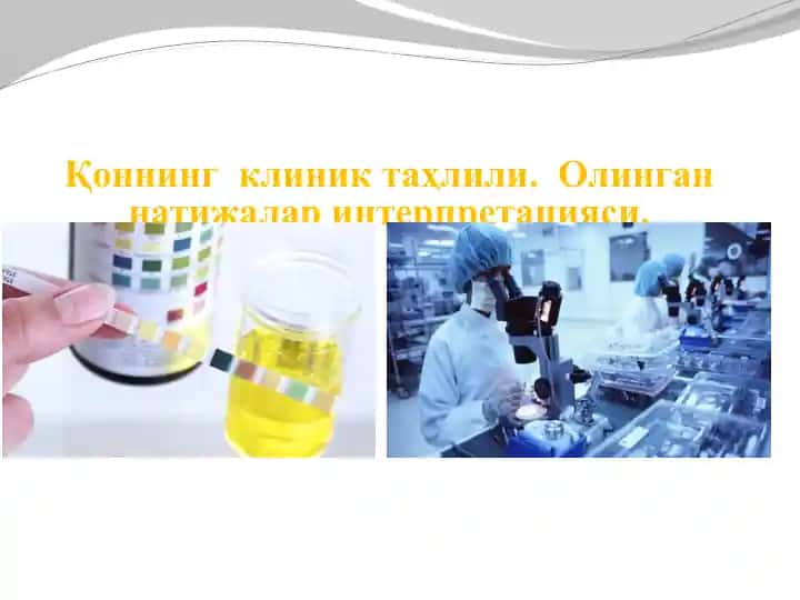 Қоннинг клиник таҳлили. Олинган натижалар интерпретацияси