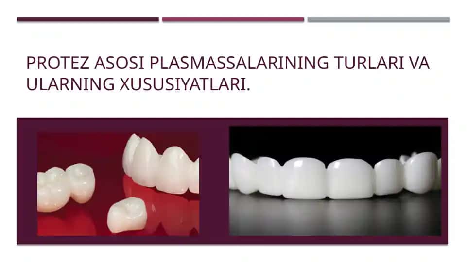 Protez asosi plasmassalarining turlari va ularning xususiyatlari