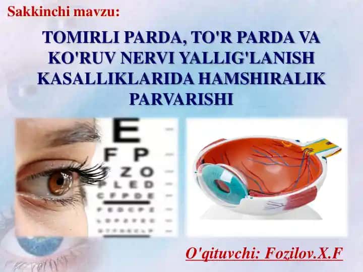 Tomirli Parda, To'r Parda va Ko'ruv Nervi Yallig'lanish Kasalliklari