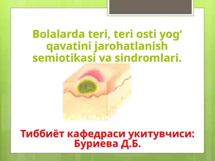 Teri osti yog‘ qavatini jarohatlanish semiotikasi va sindromlari