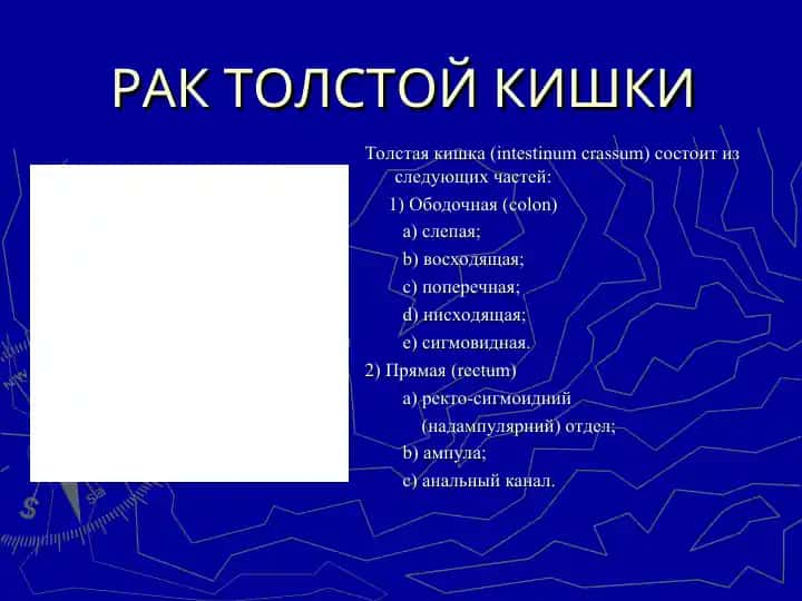 РАК ТОЛСТОЙ КИШКИ