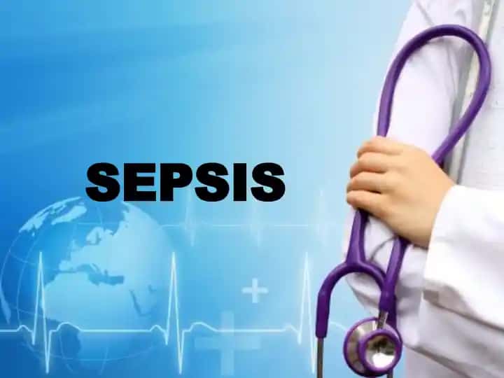 SEPSIS