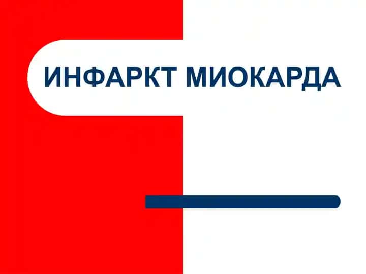 ИНФАРКТ МИОКАРДА