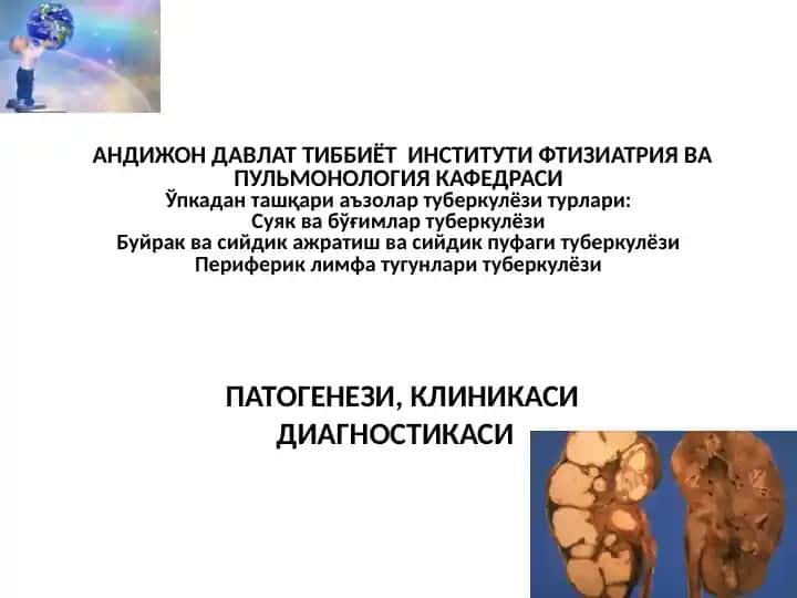 Туберкулёзи