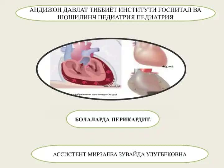 Bolalarda Perikardit
