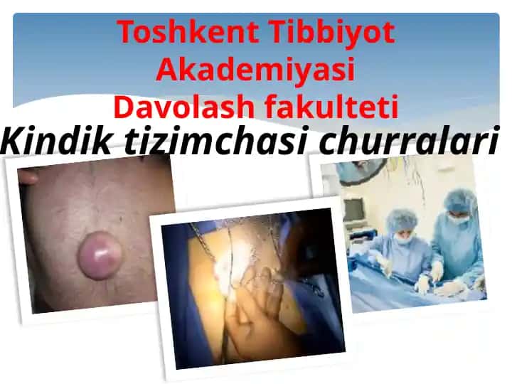 Kindiktizimchasichurralari