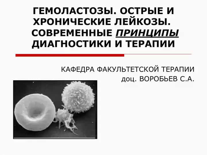 Гемоластозы. Острые и хронические лейкозы. Современные принципы диагностики и терапии