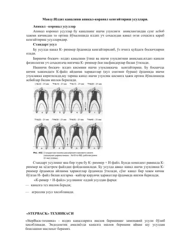 Илдиз каналини апикал-коранал кенгайтириш усуллари
