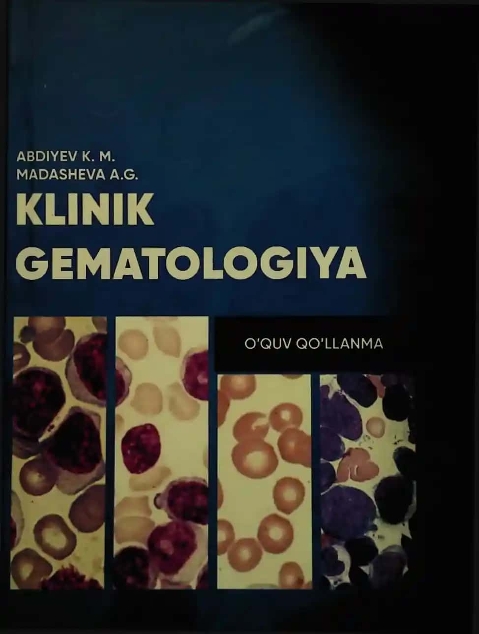 KLINIK GEMATOLOGIYA O’quv qo'llanma