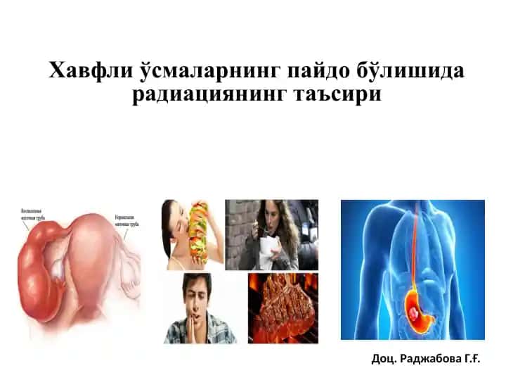 Hаvflі ўsmаlаrnіng pаіdо bўlіshіdа rаdіаtsіуаnnіng tаъsіrі