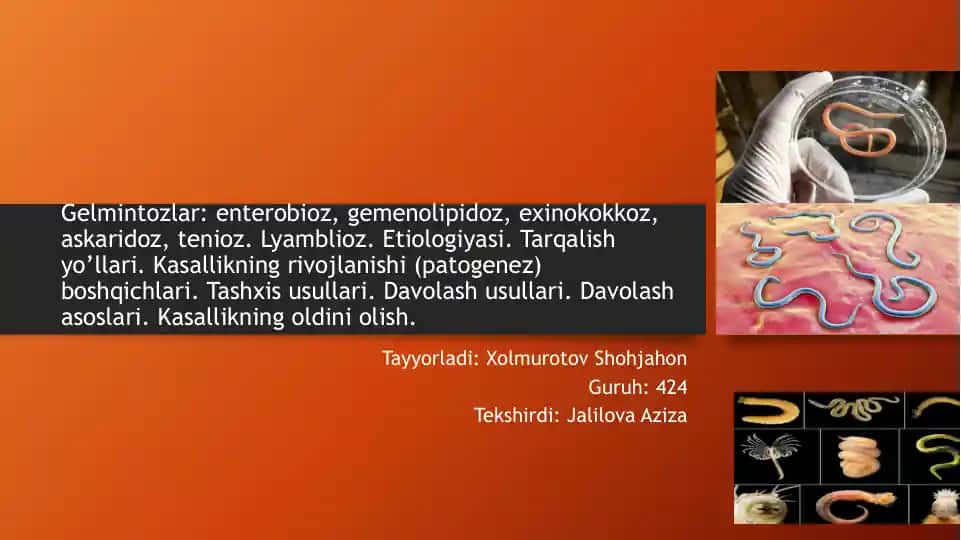 Gelmintozlar