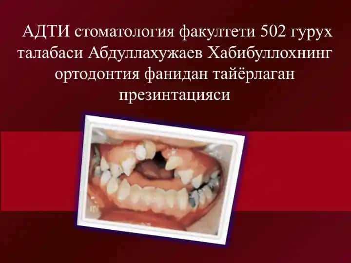 Ортодонтия фани